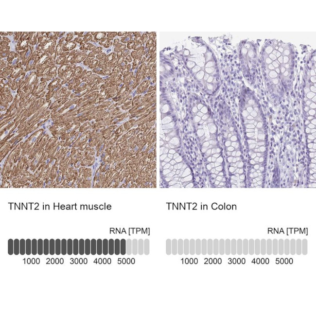 Cardiac Troponin T Antibody