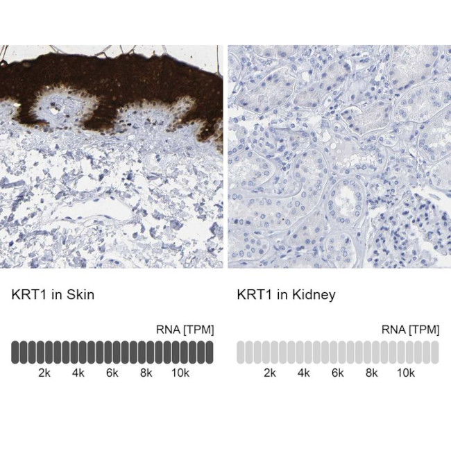 Cytokeratin 1 Antibody