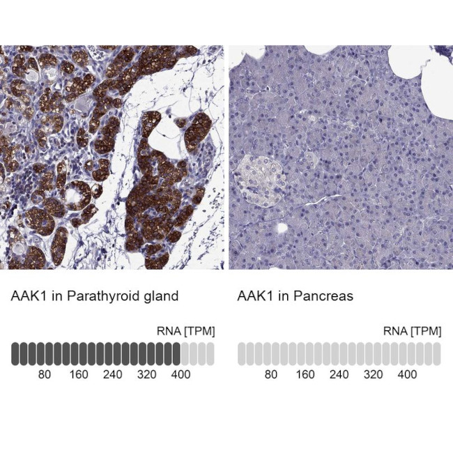 AAK1 Antibody