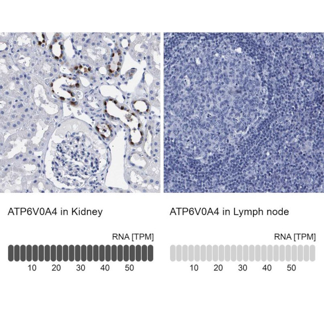 ATP6V0A4 Antibody