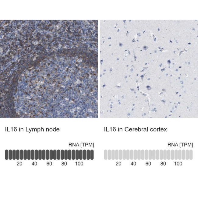 IL-16 Antibody