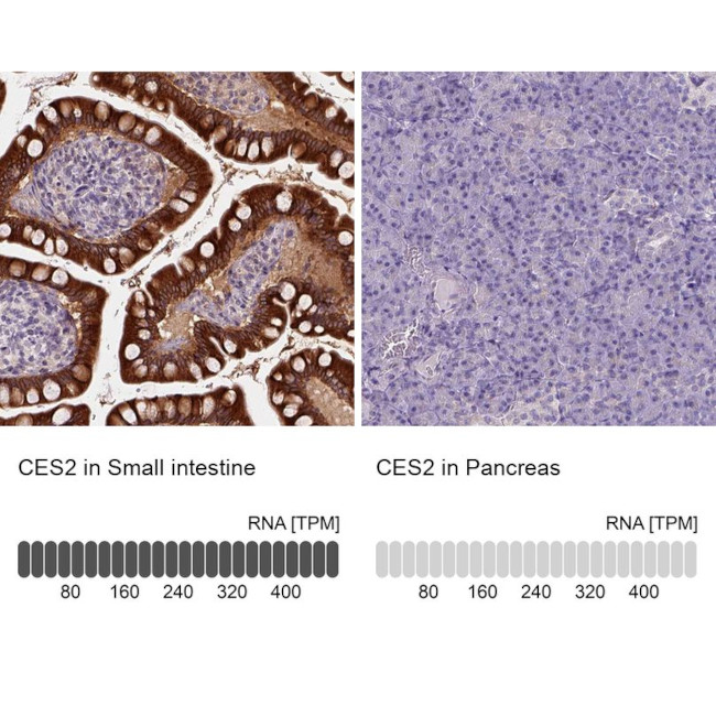 CES2 Antibody