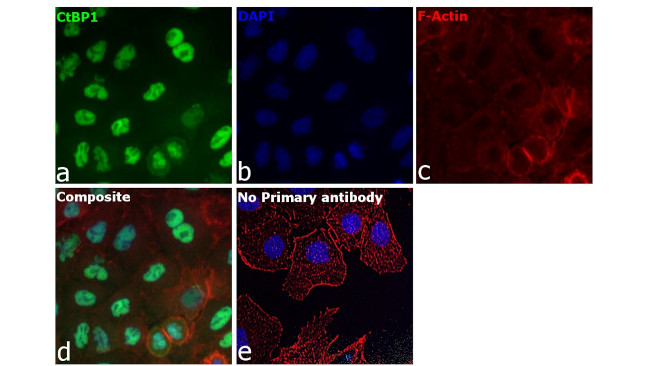 CtBP1 Antibody in Immunocytochemistry (ICC/IF)