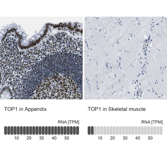 TOP1 Antibody