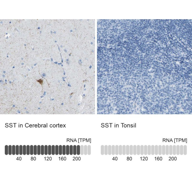 Somatostatin Antibody