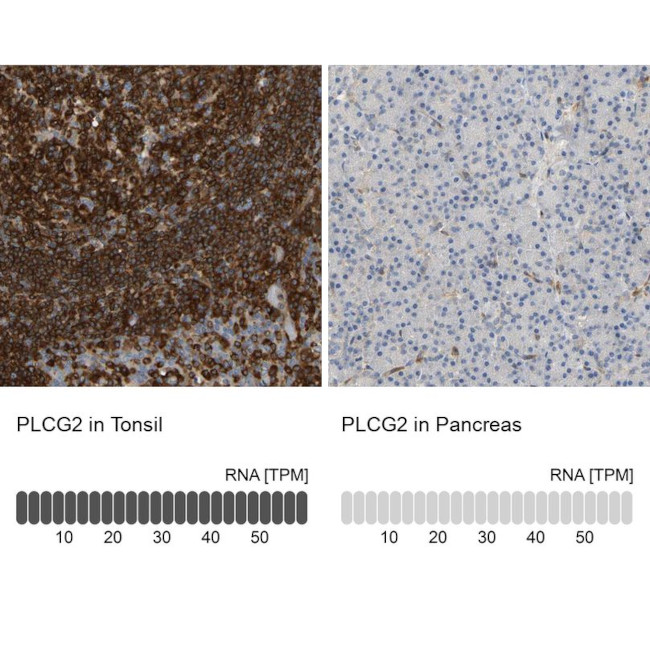 PLCG2 Antibody