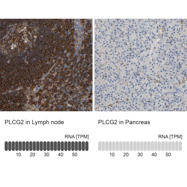 PLCG2 Antibody