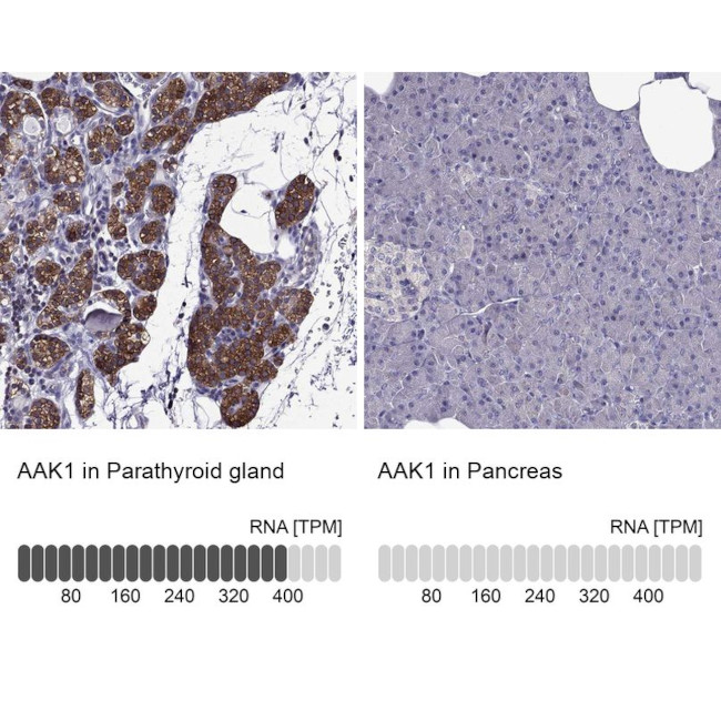 AAK1 Antibody