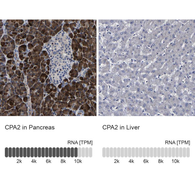 Carboxypeptidase A2 Antibody