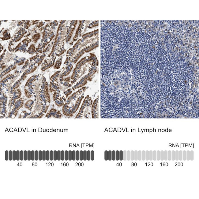 ACADVL Antibody