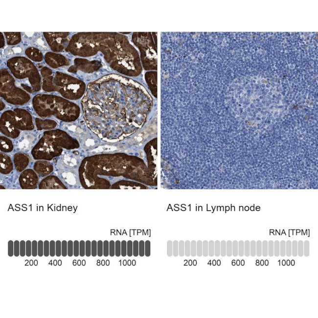 ASS1 Antibody