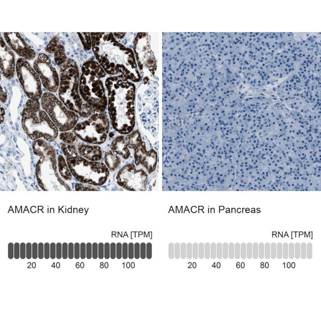 AMACR Antibody