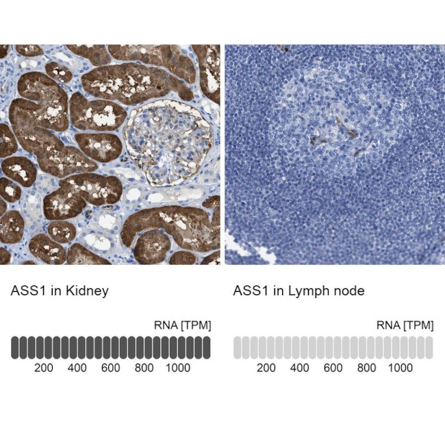 ASS1 Antibody