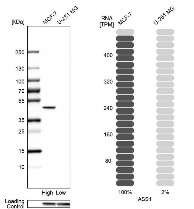 ASS1 Antibody