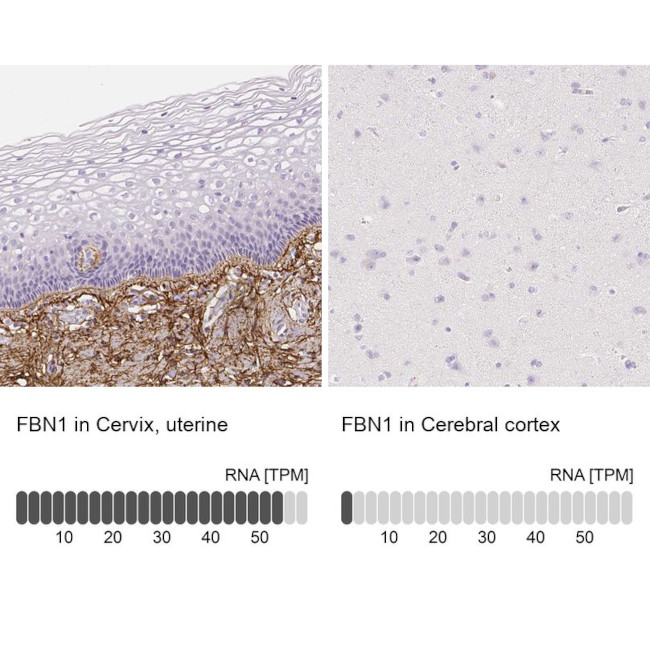 Fibrillin 1 Antibody