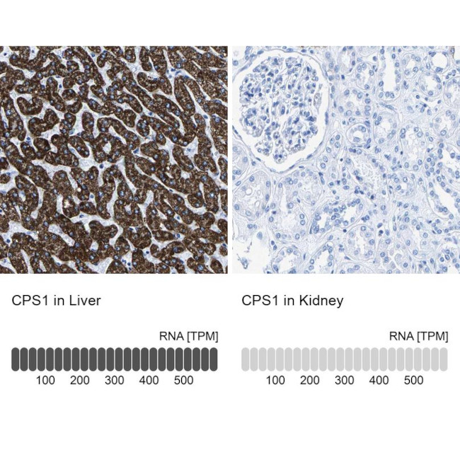 CPS1 Antibody