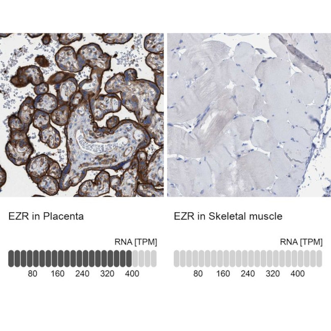 Ezrin Antibody