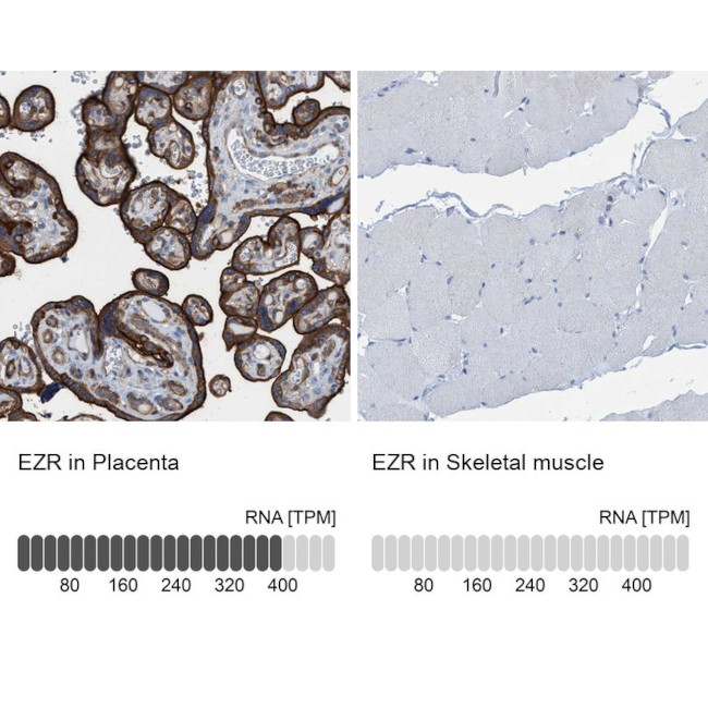 Ezrin Antibody