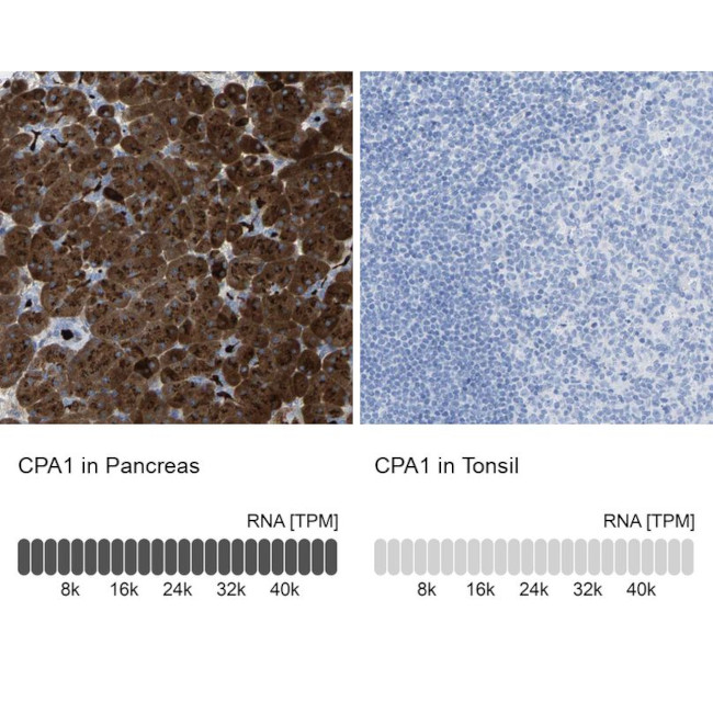 Carboxypeptidase A1 Antibody