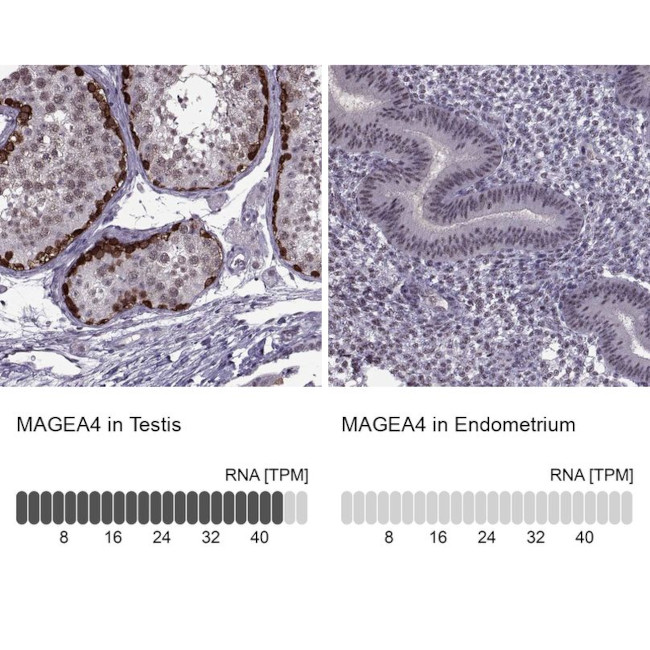 MAGEA4 Antibody