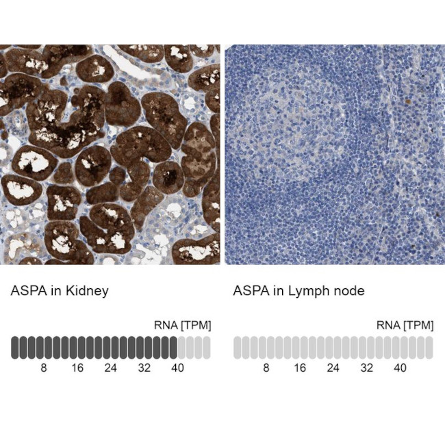 Aspartoacylase Antibody