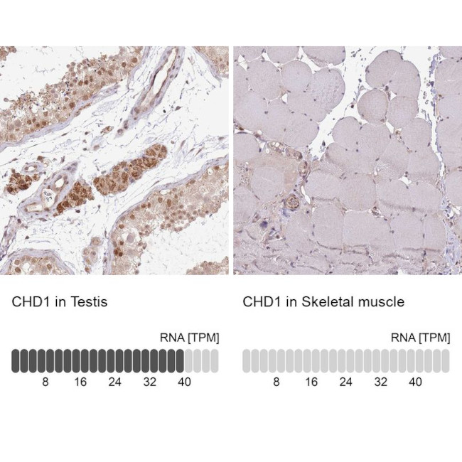 CHD1 Antibody