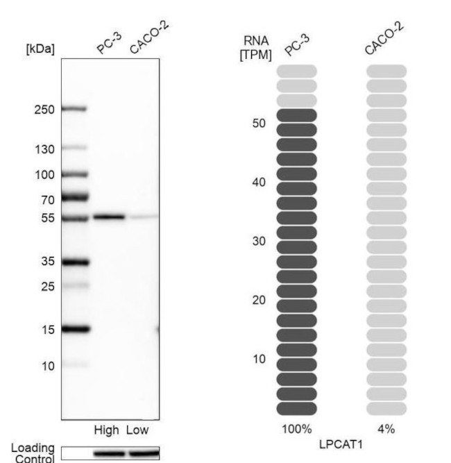 LPCAT1 Antibody