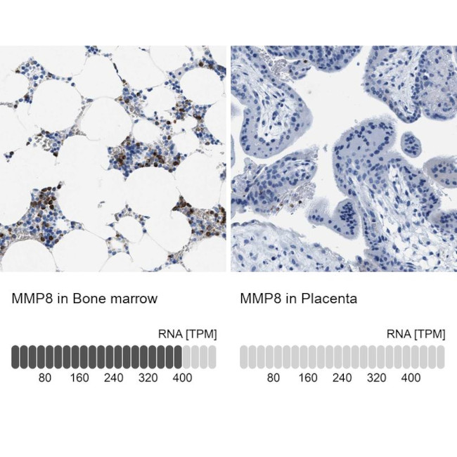 MMP8 Antibody