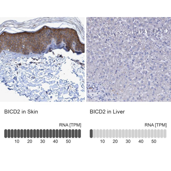 BICD2 Antibody