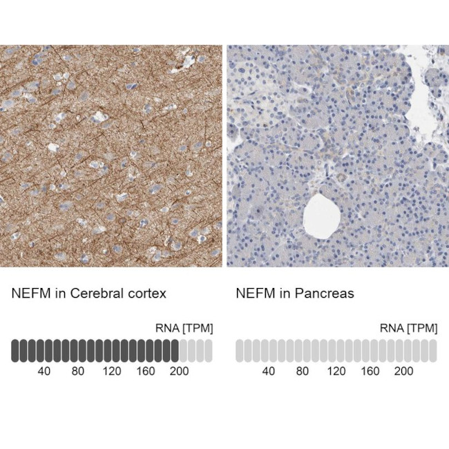 NEFM Antibody