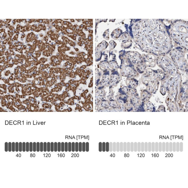 DECR1 Antibody