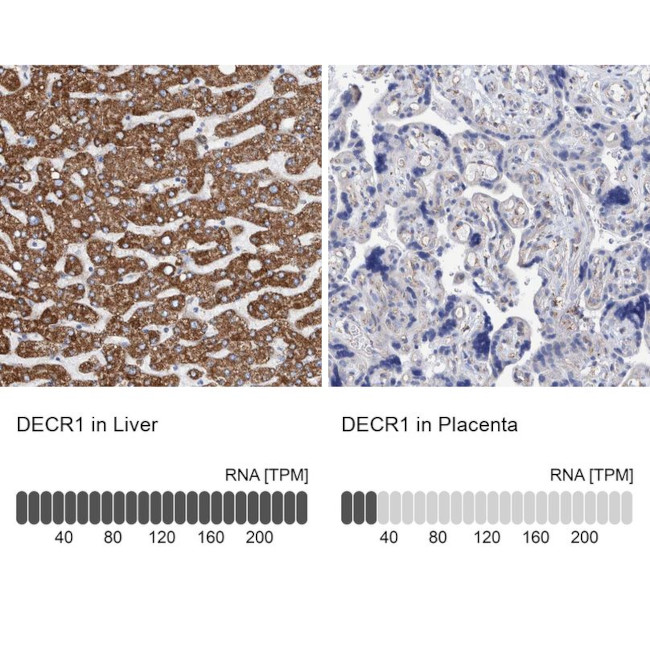 DECR1 Antibody