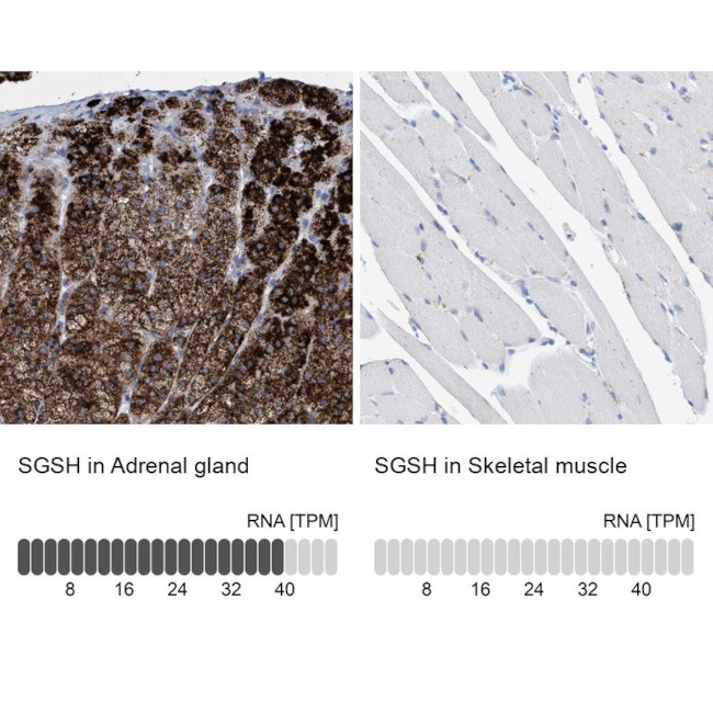 SGSH Antibody