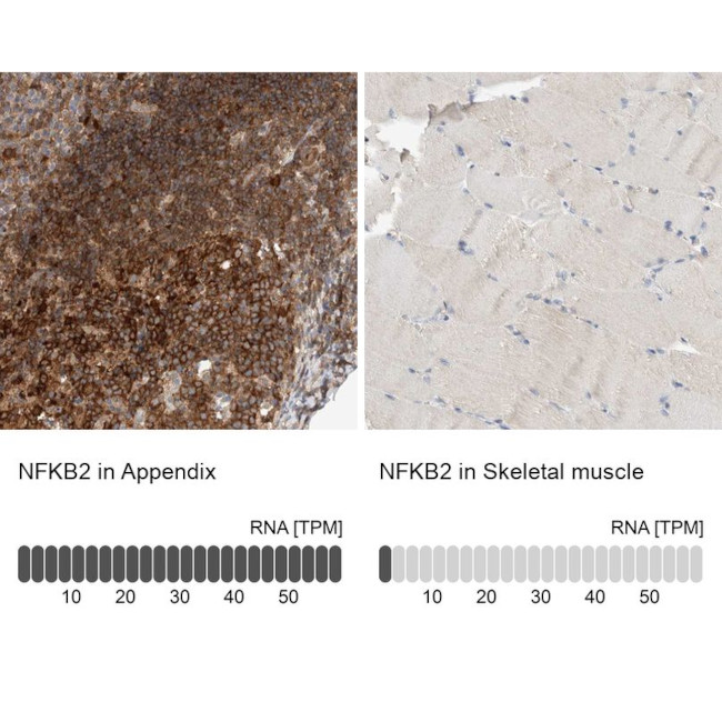 NFkB p52 Antibody