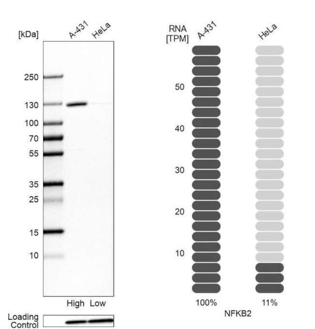 NFkB p52 Antibody