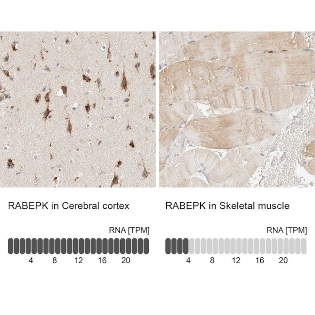 p40 Antibody