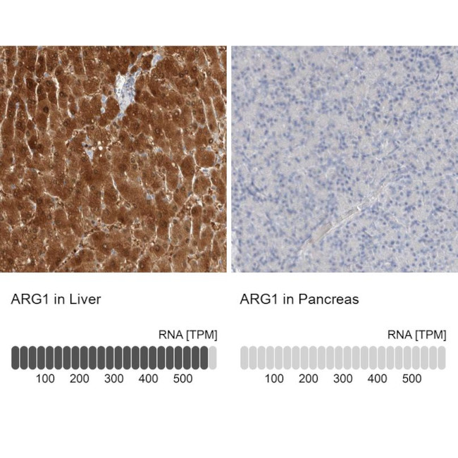 Arginase 1 Antibody