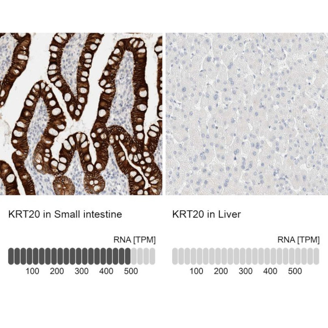 Cytokeratin 20 Antibody