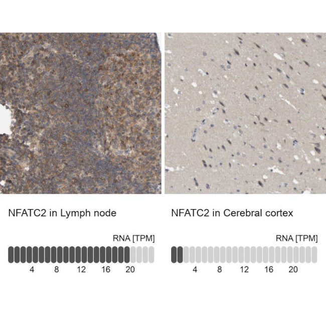 NFATC2 Antibody