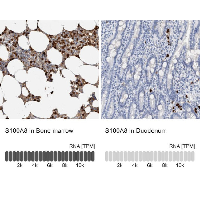 S100A8 Antibody