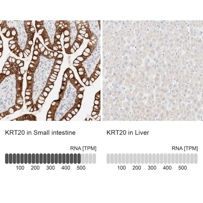 Cytokeratin 20 Antibody