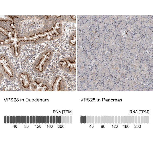 VPS28 Antibody