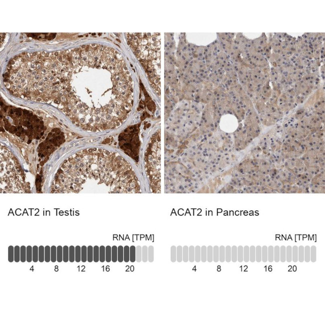 ACAT2 Antibody