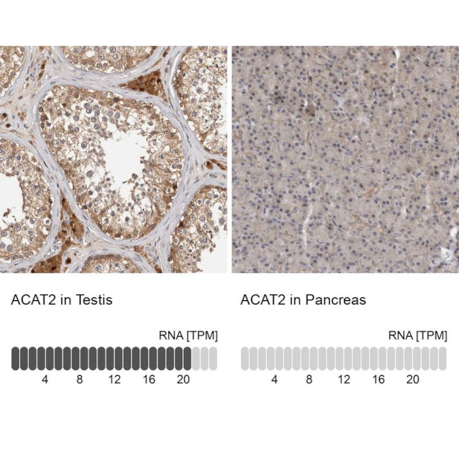 ACAT2 Antibody