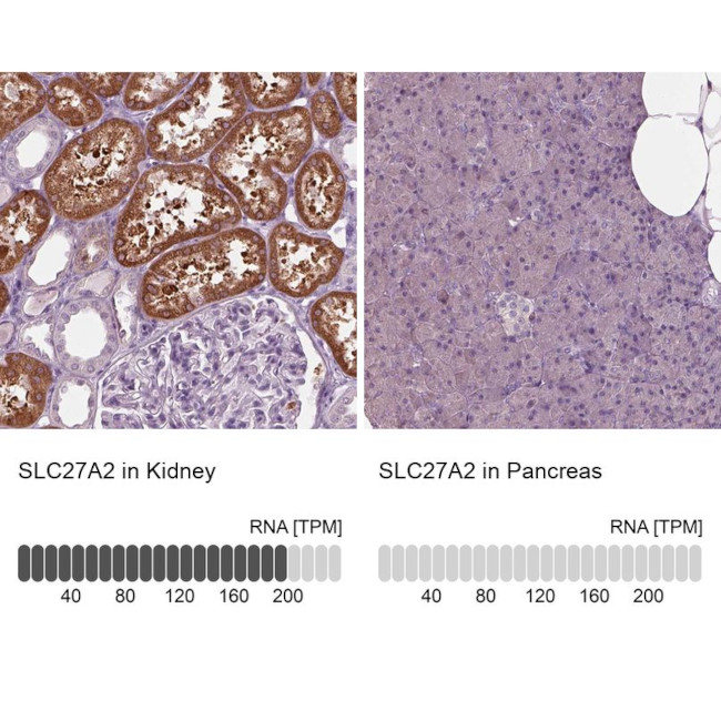 SLC27A2 Antibody