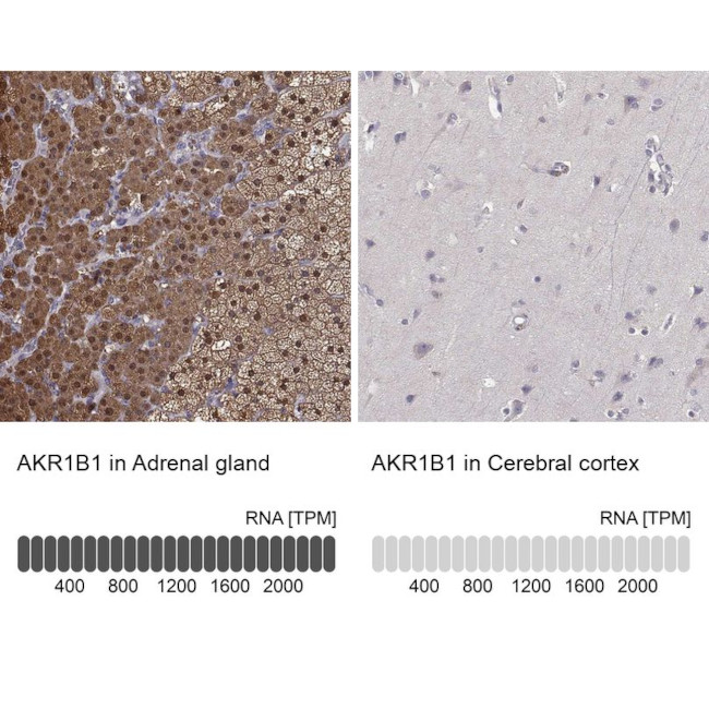 AKR1B1 Antibody