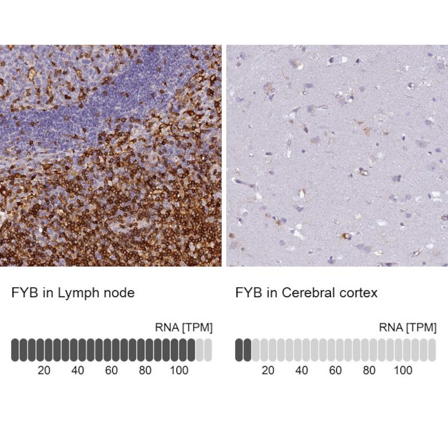 ADAP Antibody