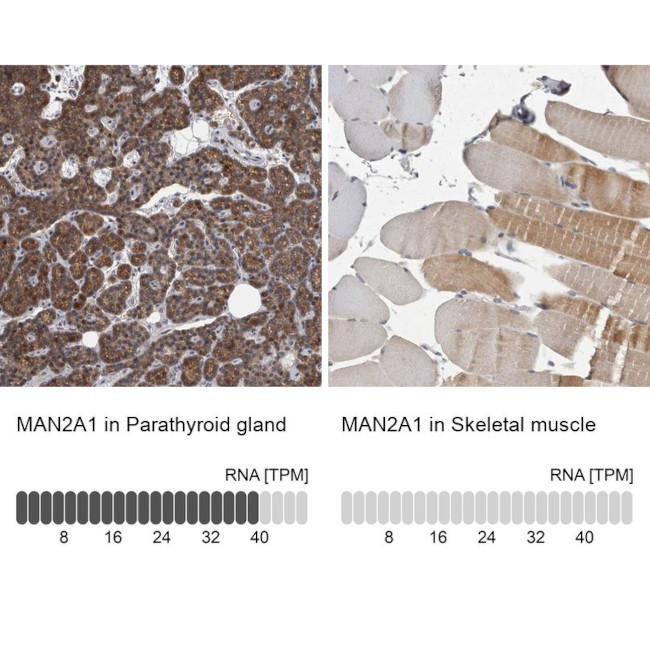 MAN2A1 Antibody