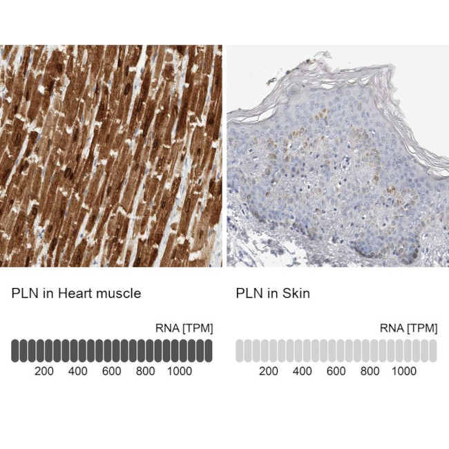 Phospholamban Antibody