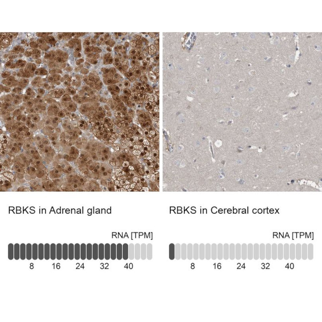 RBKS Antibody